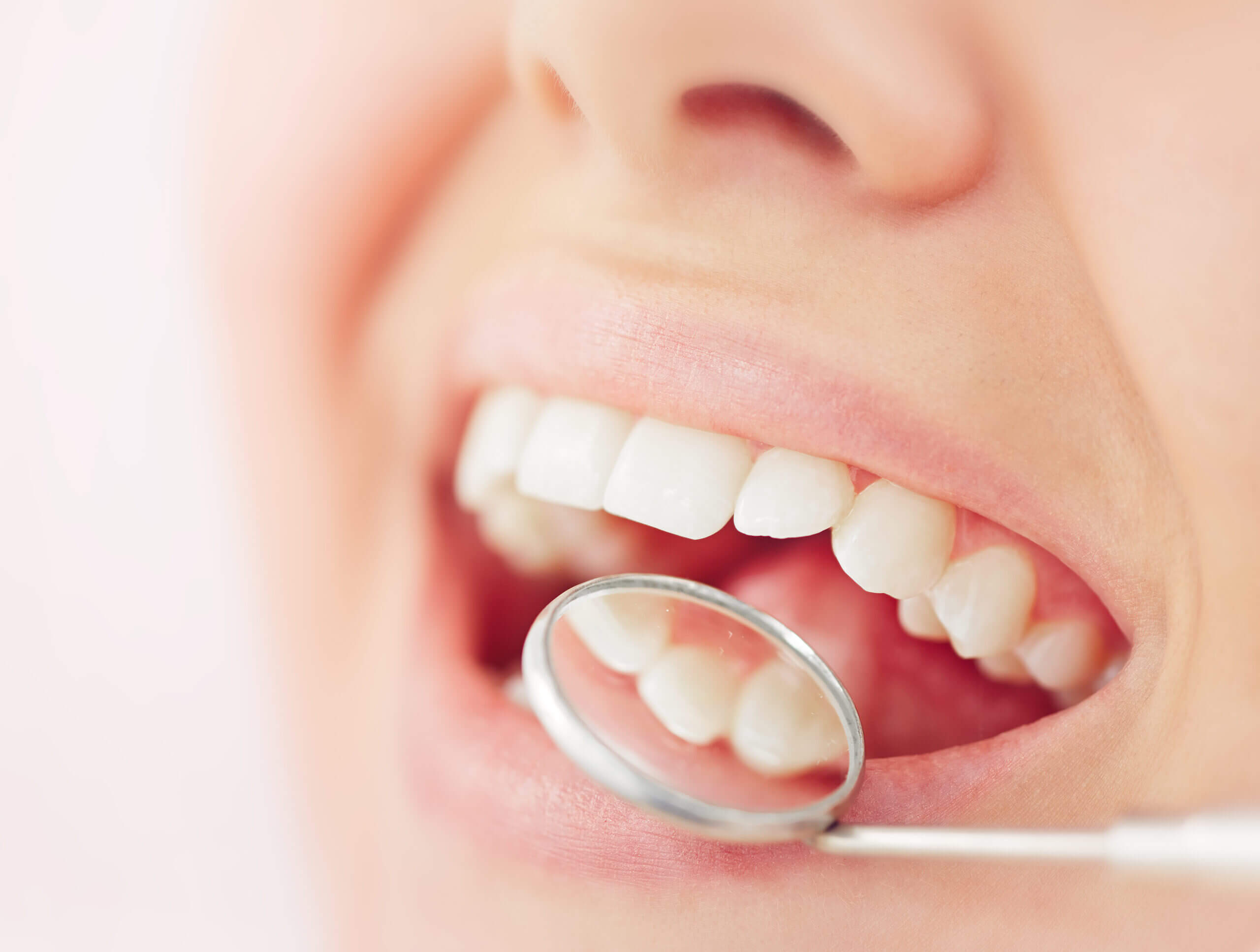 The close up image of a patient at Tony Hill Dental undergoing a dental check-up